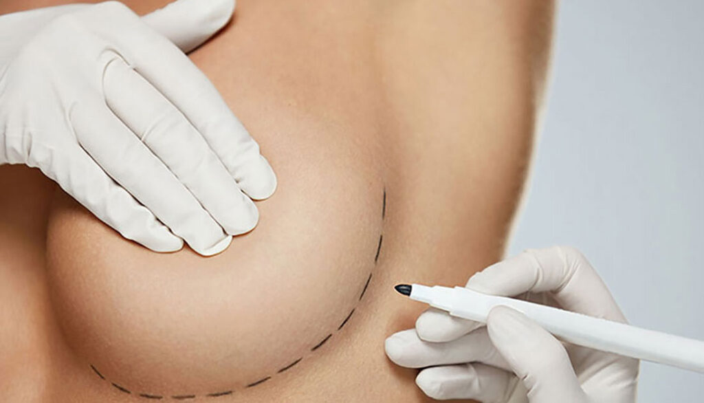 Top rated Breast Augmentation in Dubai