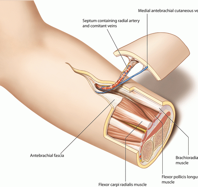 Free Flap Surgery Dubai